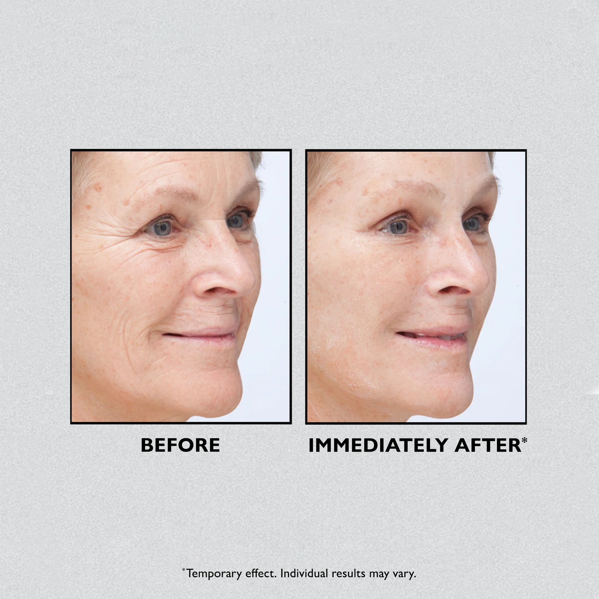 Instant FIRMx Temporary Tightener