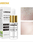 Pore Reducing Serum