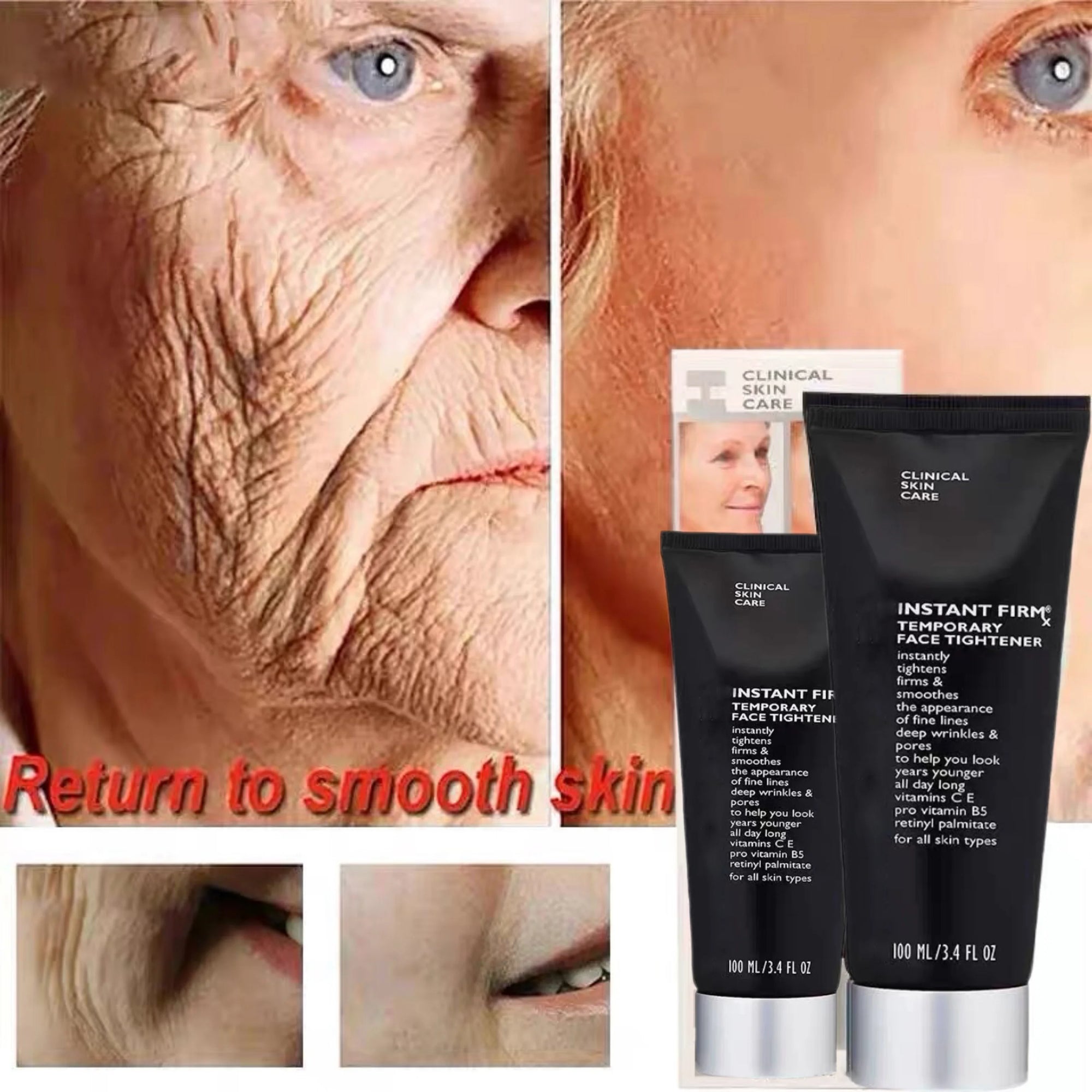 Instant FIRMx Temporary Tightener