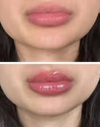 Instant Fix No Needles Lip Filler Kit: Original